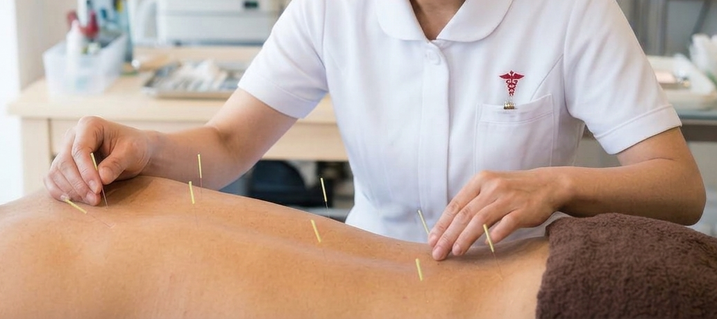 Acupuncture needles placed along the low back